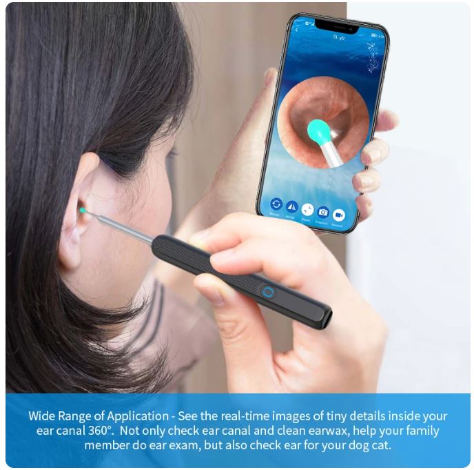 Wireless Otoscope Smart Ear Cleaning Kit with Camera, LED Light, and High Precision Ear Wax Removal Tool