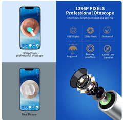 Wireless Otoscope Smart Ear Cleaning Kit with Camera, LED Light, and High Precision Ear Wax Removal Tool Luemas Hair and Beauty Store